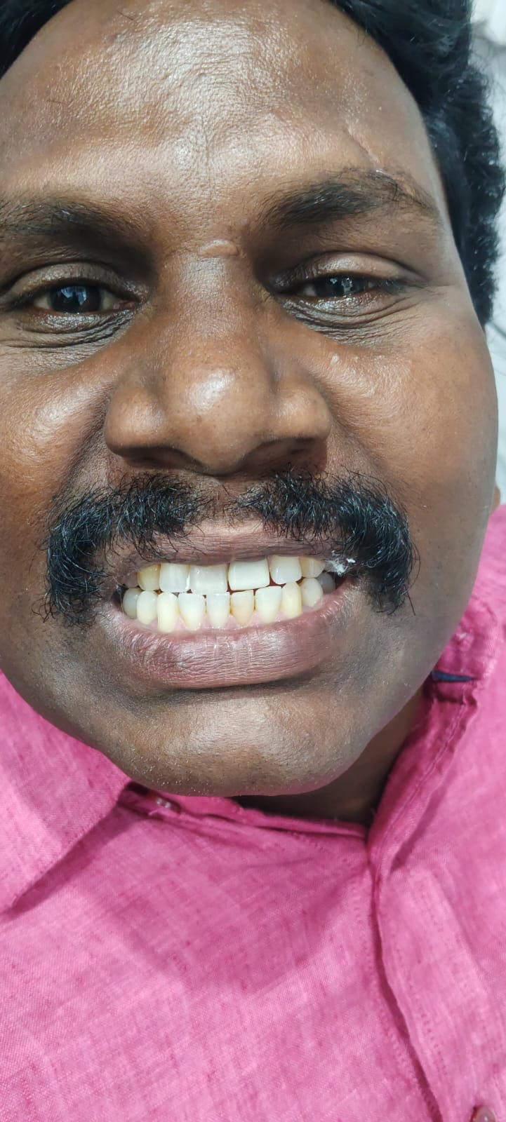 Happy Patient